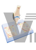 The model of rheumatic knee joint